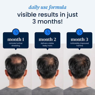 Roll-on hair recovery serum