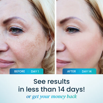 Skin Harmony - Hormonal Acne Blend